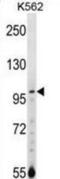 N-alpha-acetyltransferase 15, NatA auxiliary subunit antibody, abx028923, Abbexa, Western Blot image 