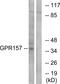 G Protein-Coupled Receptor 157 antibody, PA5-39623, Invitrogen Antibodies, Western Blot image 