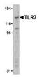 Toll Like Receptor 7 antibody, GTX77619, GeneTex, Western Blot image 