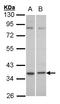 Complement Component 5a Receptor 2 antibody, LS-C185365, Lifespan Biosciences, Western Blot image 