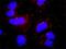 Phospholipase C Gamma 1 antibody, H00005335-M01, Novus Biologicals, Proximity Ligation Assay image 