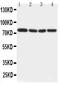 Interleukin 1 Receptor Associated Kinase 1 antibody, PA2183, Boster Biological Technology, Western Blot image 