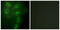 Tripartite Motif Containing 59 antibody, GTX87419, GeneTex, Immunofluorescence image 