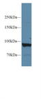 Glycogen Phosphorylase L antibody, LS-C294283, Lifespan Biosciences, Western Blot image 