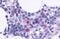 C-X-C Motif Chemokine Receptor 5 antibody, MBS243498, MyBioSource, Immunohistochemistry paraffin image 