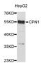 Carboxypeptidase N Subunit 1 antibody, STJ23213, St John