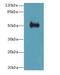 Interferon Induced Protein 44 antibody, LS-C395920, Lifespan Biosciences, Western Blot image 