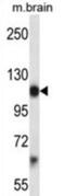 Platelet Derived Growth Factor Receptor Alpha antibody, abx027914, Abbexa, Western Blot image 