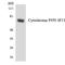 Cytochrome P450 Family 4 Subfamily F Member 11 antibody, LS-C291862, Lifespan Biosciences, Western Blot image 