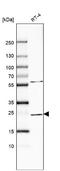 RAB11A, Member RAS Oncogene Family antibody, NBP2-68698, Novus Biologicals, Western Blot image 