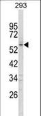 Forkhead Box C1 antibody, LS-C166216, Lifespan Biosciences, Western Blot image 