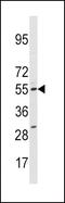 Cytochrome P450 Family 11 Subfamily A Member 1 antibody, GTX81242, GeneTex, Western Blot image 