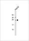 Cell Death Inducing DFFA Like Effector B antibody, 61-184, ProSci, Western Blot image 