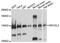 Mtr4 Exosome RNA Helicase antibody, LS-C748318, Lifespan Biosciences, Western Blot image 