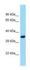 Phosphatidylinositol Transfer Protein Alpha antibody, NBP1-98374, Novus Biologicals, Western Blot image 