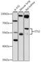 ETS Proto-Oncogene 2, Transcription Factor antibody, STJ29468, St John