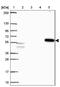 Activin A Receptor Type 1B antibody, NBP2-39003, Novus Biologicals, Western Blot image 