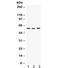 Cyclase Associated Actin Cytoskeleton Regulatory Protein 1 antibody, R32375, NSJ Bioreagents, Western Blot image 