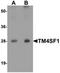 Transmembrane 4 L Six Family Member 1 antibody, orb75584, Biorbyt, Western Blot image 