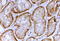 Solute Carrier Family 26 Member 1 antibody, TA326317, Origene, Immunohistochemistry paraffin image 