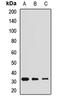 Calbindin 2 antibody, LS-C667726, Lifespan Biosciences, Western Blot image 