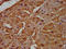 MCC Regulator Of WNT Signaling Pathway antibody, LS-C680832, Lifespan Biosciences, Immunohistochemistry paraffin image 