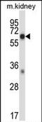 Mitogen-Activated Protein Kinase Kinase Kinase 2 antibody, PA5-71859, Invitrogen Antibodies, Western Blot image 