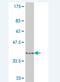 Homeodomain Interacting Protein Kinase 2 antibody, H00028996-M08, Novus Biologicals, Western Blot image 