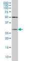 Crystallin Beta B1 antibody, H00001414-M03, Novus Biologicals, Western Blot image 