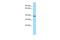 Protein Geranylgeranyltransferase Type I Subunit Beta antibody, A11559, Boster Biological Technology, Western Blot image 