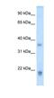 Growth Hormone 2 antibody, NBP1-59316, Novus Biologicals, Western Blot image 