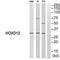 Homeobox D12 antibody, A11160-1, Boster Biological Technology, Western Blot image 