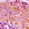 BCL2 Interacting Killer antibody, LS-C353908, Lifespan Biosciences, Immunohistochemistry paraffin image 