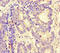 MYC Associated Factor X antibody, LS-C678584, Lifespan Biosciences, Immunohistochemistry paraffin image 