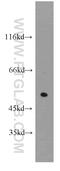 Chitinase Acidic antibody, 21484-1-AP, Proteintech Group, Western Blot image 