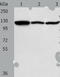 Heat Shock Protein Family H (Hsp110) Member 1 antibody, TA321776, Origene, Western Blot image 