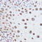 Spliceosome Associated Factor 1, Recruiter Of U4/U6.U5 Tri-SnRNP antibody, GTX64573, GeneTex, Immunoprecipitation image 