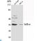 NFKB Inhibitor Alpha antibody, LS-C814109, Lifespan Biosciences, Western Blot image 