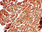 ADAM Metallopeptidase With Thrombospondin Type 1 Motif 4 antibody, LS-C369225, Lifespan Biosciences, Immunohistochemistry paraffin image 