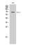 Ephrin A2 antibody, STJ92888, St John