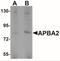 Amyloid Beta Precursor Protein Binding Family A Member 2 antibody, NBP2-41127, Novus Biologicals, Western Blot image 