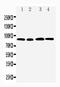 Hyaluronan mediated motility receptor antibody, PA1592, Boster Biological Technology, Western Blot image 