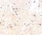 Solute Carrier Family 19 Member 2 antibody, PA5-50262, Invitrogen Antibodies, Immunohistochemistry paraffin image 