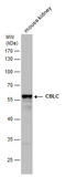 Cbl Proto-Oncogene C antibody, GTX110775, GeneTex, Western Blot image 