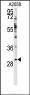 WW Domain Binding Protein 2 antibody, AP14578PU-N, Origene, Western Blot image 