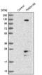 Transmembrane Protein 186 antibody, NBP1-88452, Novus Biologicals, Western Blot image 