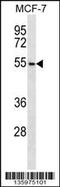 Armadillo Repeat Containing X-Linked 1 antibody, 58-487, ProSci, Western Blot image 