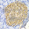 HtrA Serine Peptidase 2 antibody, A5762, ABclonal Technology, Immunohistochemistry paraffin image 