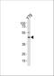 Retinol Dehydrogenase 10 antibody, A08376, Boster Biological Technology, Western Blot image 