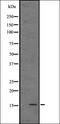 Interferon Alpha 8 antibody, orb337769, Biorbyt, Western Blot image 